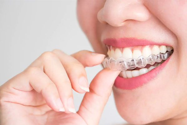 Invisalign treatment 