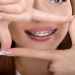 A Short Guide on Practical Advantages of Self-Ligating Braces