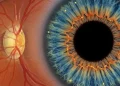 7 Signs You May Need Treatment for Diabetic Retinopathy