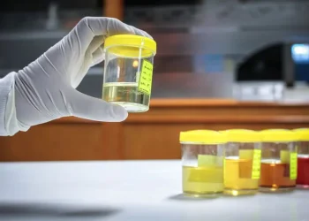 Synthetic Urine Guide: Key Components And Basic Product Characteristics