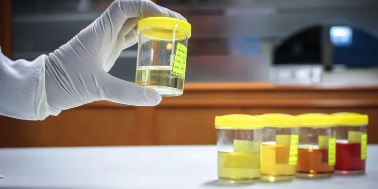 Synthetic Urine Guide: Key Components And Basic Product Characteristics